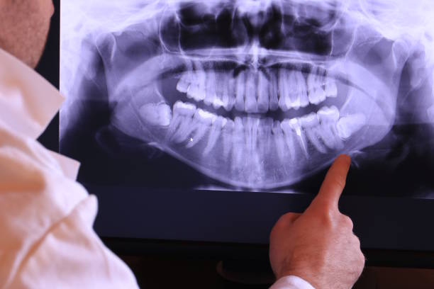Best Dental Abscess Treatment in Lonaconing, MD